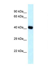 BCAT2 antibody LS-C145747 Western blot of Placenta lysate. Antibody concentration 1 ug/ml.
