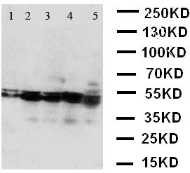 WB of BCAT2 antibody. Lane 1: A431 Cell Lysate. Lane 2: SW620 Cell Lysate. Lane 3: SMMC Cell Lysate. Lane 4: JURKAT Cell Lysate. Lane 5: CEM Cell Lysate.