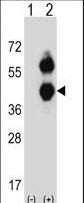 Western blot of BCAT2 (arrow) using rabbit polyclonal BCAT2 Antibody. 293 cell lysates (2 ug/lane) either nontransfected (Lane 1) or transiently transfected (Lane 2) with the BCAT2 gene.
