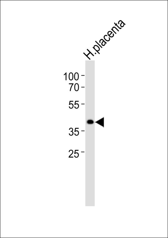 Western blot of lysate from human placenta tissue lysate with BCAT2 Antibody. Antibody was diluted at 1:1000. A goat anti-rabbit IgG H&L (HRP) at 1:5000 dilution was used as the secondary antibody. Lysate at 35 ug.