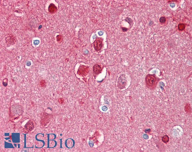 Anti-BCHE / Cholinesterase antibody IHC of human brain, cortex. Immunohistochemistry of formalin-fixed, paraffin-embedded tissue after heat-induced antigen retrieval. Antibody LS-B7912 dilution 1:200.