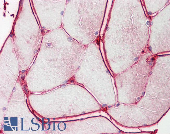 Anti-BCHE / Cholinesterase antibody IHC of human skeletal muscle. Immunohistochemistry of formalin-fixed, paraffin-embedded tissue after heat-induced antigen retrieval. Antibody LS-B7912 dilution 1:200.