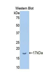 Western blot of recombinant BCHE / Cholinesterase.
