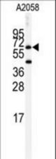 Western blot of anti-BCHE Antibody in A2058 cell line lysates (35 ug/lane). BCHE (arrow) was detected using the purified antibody.