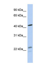 BCKDHA antibody LS-C111808 Western blot of MCF7 cell lysate.