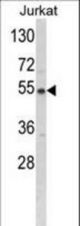 Western blot of BCKDHA Antibody in Jurkat cell line lysates (35 ug/lane). BCKDHA (arrow) was detected using the purified antibody.