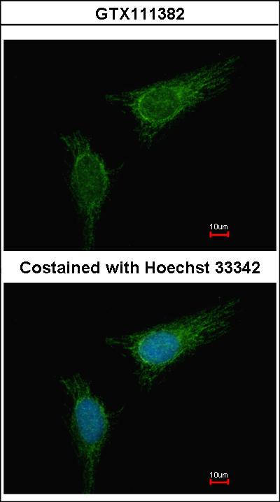 Immunofluorescence of methanol-fixed HeLa, using BCKDHA antibody at 1:500 dilution.