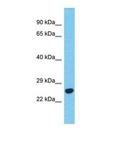 Western blot of Human Thyroid tumor. BCKDHB antibody dilution 1.0 ug/ml.