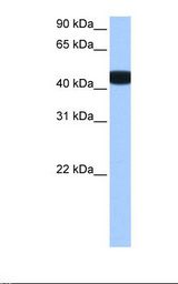 Fetal brain cell lysate. Antibody concentration: 0.5 ug/ml. Gel concentration: 12%.