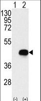 Western blot of BCKDK (arrow) using rabbit polyclonal BCKDK Antibody. 293 cell lysates (2 ug/lane) either nontransfected (Lane 1) or transiently transfected with the BCKDK gene (Lane 2) (Origene Technologies).