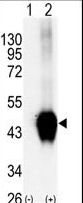 Western blot of BCKDK (arrow) using rabbit polyclonal BCKDK Antibody (C-term T340) (RB05257). 293 cell lysates (2 ug/lane) either nontransfected (Lane 1) or transiently transfected with the BCKDK gene (Lane 2) (Origene Technologies).