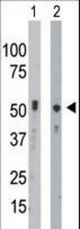 The anti-BCKDK antibody is used in Western blot to detect BCKDK in mouse intestine tissue lysate (Lane 1) and HeLa cell lysate (Lane 2).