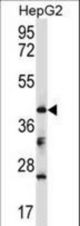 Mouse Bckdk Antibody western blot of HepG2 cell line lysates (35 ug/lane). The Bckdk antibody detected the Bckdk protein (arrow).