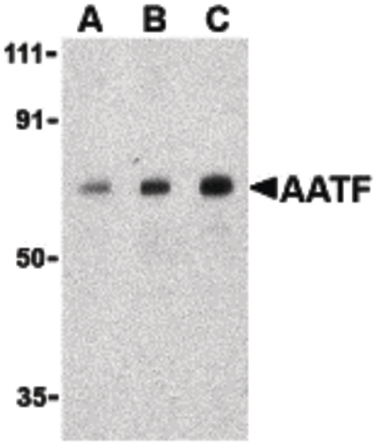 Western blot of AATF in human small intestine cell lysate with AATF antibody at (A) 0.5, (B) 1 and (C) 2 ug/ml.