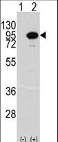 Western blot of ACO2 (arrow) using rabbit polyclonal ACO2 Antibody. 293 cell lysates (2 ug/lane) either nontransfected (Lane 1) or transiently transfected with the ACO2 gene (Lane 2) (Origene Technologies).