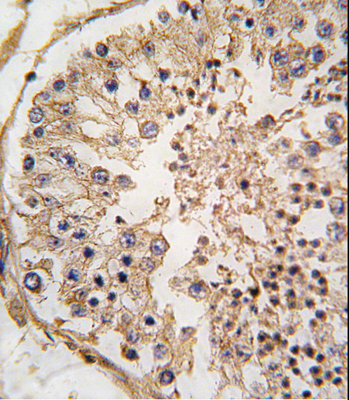 Formalin-fixed and paraffin-embedded human testis tissue reacted with Bcl-2 BH3 Domain Antibody, which was peroxidase-conjugated to the secondary antibody, followed by DAB staining. This data demonstrates the use of this antibody for immunohistochemistry; clinical relevance has not been evaluated.