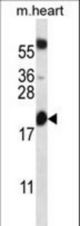 BCL2 Antibody western blot of mouse heart tissue lysates (35 ug/lane). The BCL2 antibody detected the BCL2 protein (arrow).