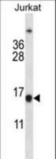 BCL2 Antibody western blot of Jurkat cell line lysates (35 ug/lane). The BCL2 antibody detected the BCL2 protein (arrow).