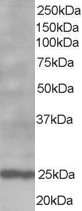 Staining (1 ug/ml) of Human Lymph Node lysate (RIPA buffer, 35 ug total protein per lane). Primary incubated for 1 hour. Detected using chemiluminescence.