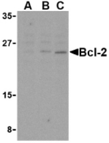 Western blot of Bcl-2 in A-20 cell lysates with Bcl-2 antibody at (A) 1, (B) 2, and (C) 4 ug/ml.
