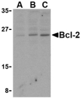 Western blot of Bcl-2 in Daudi cell lysates with Bcl-2 antibody at (A) 1, (B) 2, and (C) 4 ug/ml.