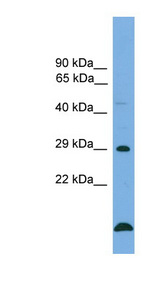BCL2 / Bcl-2 antibody LS-C117075 Western blot of Jurkat lysate.