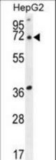 ACOT11 Antibody western blot of HepG2 cell line lysates (35 ug/lane). The ACOT11 antibody detected the ACOT11 protein (arrow).