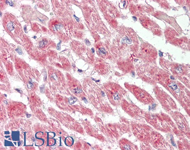 Human Heart: Formalin-Fixed, Paraffin-Embedded (FFPE)
