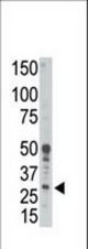 Western blot of anti-Bcl2-related Protein A1 antibody in human placenta tissue lysate. Bcl2-related Protein A1 (arrow) was detected using purified antibody. Secondary HRP-anti-rabbit was used for signal visualization with chemiluminescence.