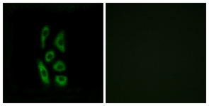 Immunofluorescence of A549 cells, using ACOT12 Antibody. The picture on the right is treated with the synthesized peptide.