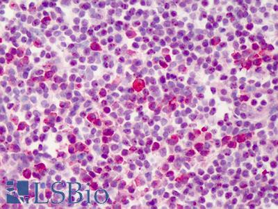 Anti-BCL2L1 / Bcl-x antibody IHC of human tonsil. Immunohistochemistry of formalin-fixed, paraffin-embedded tissue after heat-induced antigen retrieval. Antibody LS-B451 concentration 2.5 ug/ml.
