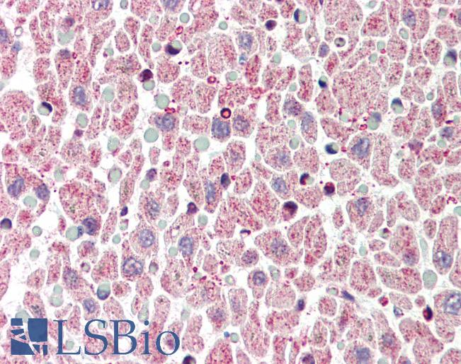 Anti-BCL2L1 / Bcl-x antibody IHC of human heart. Immunohistochemistry of formalin-fixed, paraffin-embedded tissue after heat-induced antigen retrieval. Antibody LS-B451 concentration 5 ug/ml.