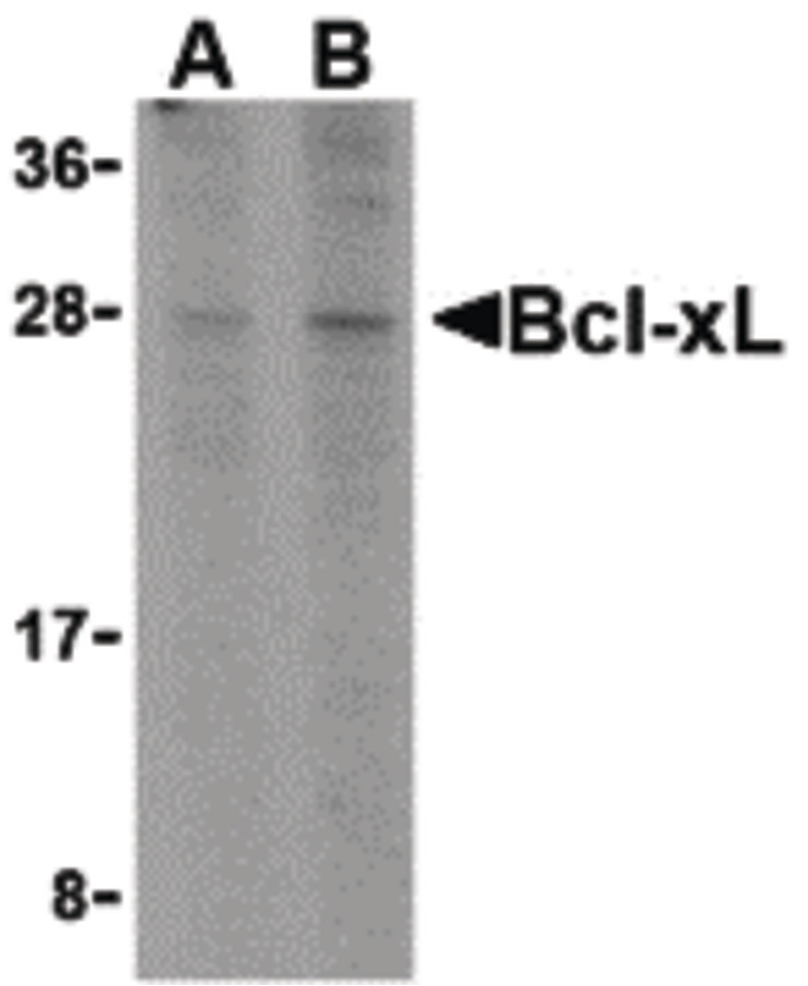 Western blot of Bcl-xL in A549 cell lysates with Bcl-xL antibody at (A) 1 and (B) 2 ug/ml.