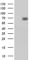 HEK293T cells were transfected with the pCMV6-ENTRY control (Left lane) or pCMV6-ENTRY ACOT12 (Right lane) cDNA for 48 hrs and lysed. Equivalent amounts of cell lysates (5 ug per lane) were separated by SDS-PAGE and immunoblotted with anti-ACOT12.