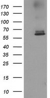 HEK293T cells were transfected with the pCMV6-ENTRY control (Left lane) or pCMV6-ENTRY ACOT12 (Right lane) cDNA for 48 hrs and lysed. Equivalent amounts of cell lysates (5 ug per lane) were separated by SDS-PAGE and immunoblotted with anti-ACOT12.