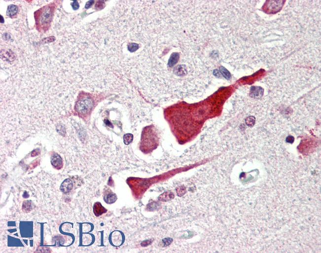 Anti-BCL2L10 / BCL-B antibody IHC of human brain, cortex. Immunohistochemistry of formalin-fixed, paraffin-embedded tissue after heat-induced antigen retrieval. Antibody LS-B452 concentration 5 ug/ml.