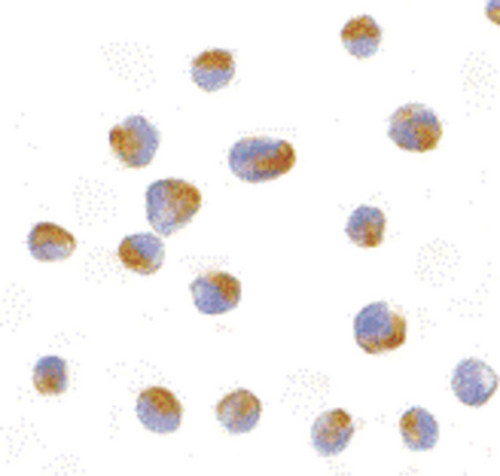 Immunocytochemistry of Bcl-B in Jurkat cells with Bcl-B antibody at 10 ug/ml.