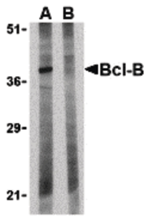 Western blot of Bcl-B in Jurkat lysate with Bcl-B antibody at 1 ug/ml in the (A) absence and (B) presence of blocking peptide.