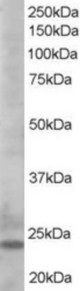 Antibody staining (0.5 ug/ml) of K562lysate (RIPA buffer, 35 ug total protein per lane). Primary incubated for 1 hour. Detected by Western blot of chemiluminescence.