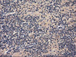 IHC of paraffin-embedded Human lymphoma tissue using anti-ACOT12 mouse monoclonal antibody.