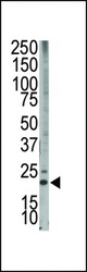 The anti-Bim BH3 domain antibody is used in Western blot to detect Bim BH3 in HL-60 cell lysate.