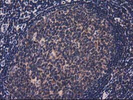 IHC of paraffin-embedded Human lymph node tissue using anti-ACOT12 mouse monoclonal antibody.