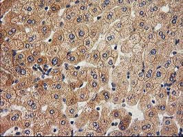 IHC of paraffin-embedded Human liver tissue using anti-ACOT12 mouse monoclonal antibody.