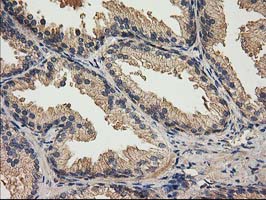 IHC of paraffin-embedded Human prostate tissue using anti-ACOT12 mouse monoclonal antibody.