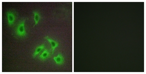 Immunofluorescence of HepG2 cells, using BCLW Antibody. The picture on the right is treated with the synthesized peptide.