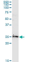 BCL2L2 monoclonal antibody (M01), clone 2E4. Western Blot analysis of BCL2L2 expression in human colon.