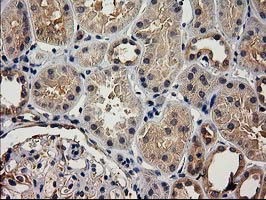 IHC of paraffin-embedded Human Kidney tissue using anti-ACOT12 mouse monoclonal antibody.