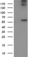 HEK293T cells were transfected with the pCMV6-ENTRY control (Left lane) or pCMV6-ENTRY ACOT12 (Right lane) cDNA for 48 hrs and lysed. Equivalent amounts of cell lysates (5 ug per lane) were separated by SDS-PAGE and immunoblotted with anti-ACOT12.