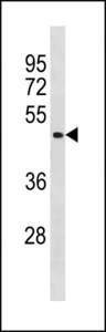 BCL6B Antibody western blot of A549 cell line lysates (35 ug/lane). The BCL6B antibody detected the BCL6B protein (arrow).