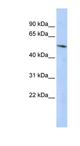 BCL6B antibody LS-C101815 Western blot of HepG2 cell lysate.